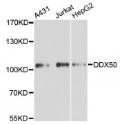 Western blot analysis of extracts of various cell lines, using DDX50 antibody (abx124775) at 1:3000 dilution.