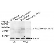 Western blot analysis of extracts of HeLa and 293 cells, using Phospho-PKCδ/θ-S643/676 antibody (abx124934) at 1/1000 dilution. HeLa cells were treated by PMA/TPA (200nM) for 15 minutes after serum-starvation overnight. 293 cells were treated by PMA/TPA (200nM) for 30 minutes after serum-starvation overnight.