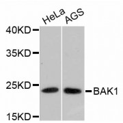 Western blot analysis of extracts of various cell lines, using BAK1 antibody (abx125297).