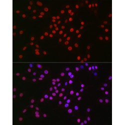 Induced Myeloid Leukemia Cell Differentiation Protein (MCL1) Antibody