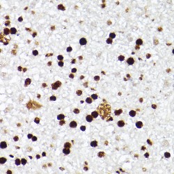 Induced Myeloid Leukemia Cell Differentiation Protein (MCL1) Antibody