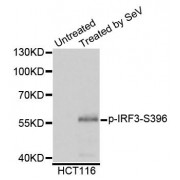 Western blot analysis of extracts of HCT116 cells, using Phospho-IRF3-S396 antibody (abx125459) at 1/1000 dilution.