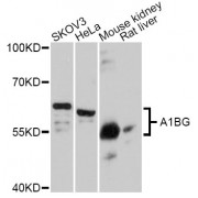 Western blot analysis of extracts of various cell lines, using A1BG Antibody (abx125470) at 1:3000 dilution.