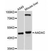 Western blot analysis of extracts of various cell lines, using AADAC antibody (abx125473) at 1/1000 dilution.