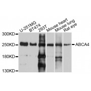 Western blot analysis of extracts of various cell lines, using ABCA4 antibody (abx125474) at 1/1000 dilution.