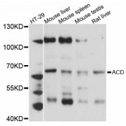 Western blot analysis of extracts of various cell lines, using ACD antibody (abx125486) at 1:3000 dilution.