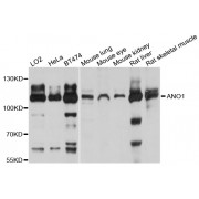 Western blot analysis of extracts of various cell lines, using ANO1 antibody (abx125518) at 1/1000 dilution.