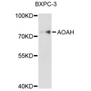 Western blot analysis of extracts of BxPC-3 cells, using AOAH antibody (abx125520) at 1/1000 dilution.