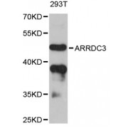 Western blot analysis of extracts of 293T cells, using ARRDC3 antibody (abx125537) at 1:3000 dilution.