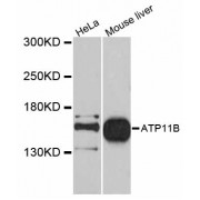 Western blot analysis of extracts of various cell lines, using ATP11B antibody (abx125548) at 1/1000 dilution.