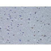 Immunohistochemistry of paraffin-embedded rat brain using BDNF antibody (abx125561) at dilution of 1/100 (40x lens).