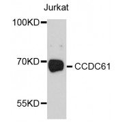 Western blot analysis of extracts of Jurkat cells, using CCDC61 antibody (abx125621) at 1/1000 dilution.