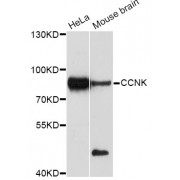 Western blot analysis of extracts of various cell lines, using CCNK Antibody (abx125628) at 1/1000 dilution.