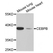Western blot analysis of extracts of various cell lines, using CEBPB antibody (abx125661) at 1/1000 dilution.