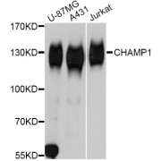 Western blot analysis of extracts of various cell lines, using CHAMP1 Antibody (abx125663) at 1:3000 dilution.