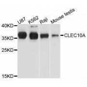 Western blot analysis of extracts of various cell lines, using CLEC10A antibody (abx125682) at 1/1000 dilution.
