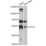 Western blot analysis of extracts of various cell lines, using CPVL antibody (abx125714) at 1:3000 dilution.