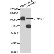 Western blot analysis of extracts of various cell lines, using CTNNB1 antibody (abx125730) at 1/1000 dilution.
