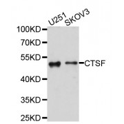 Western blot analysis of extracts of various cell lines, using CTSF antibody (abx125733) at 1/1000 dilution.