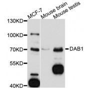 Western blot analysis of extracts of various cell lines, using DAB1 antibody (abx125745) at 1/1000 dilution.