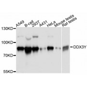 Western blot analysis of extracts of various cell lines, using DDX3Y antibody (abx125754) at 1:3000 dilution.