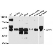 Western blot analysis of extracts of various cell lines, using DDX47 antibody (abx125755) at 1/1000 dilution.