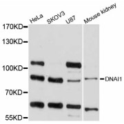 Western blot analysis of extracts of various cell lines, using DNAI1 antibody (abx125764) at 1/1000 dilution.