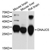 Western blot analysis of extracts of various cell lines, using DNAJC5 antibody (abx125769) at 1/1000 dilution.