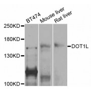 Western blot analysis of extracts of various cell lines, using DOT1L antibody (abx125778) at 1/1000 dilution.