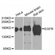 Western blot analysis of extracts of various cell lines, using EGFR antibody (abx125795) at 1/1000 dilution.