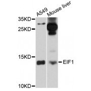 Western blot analysis of extracts of various cell lines, using EIF1 antibody (abx125803) at 1/1000 dilution.