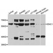 Western blot analysis of extracts of various cell lines, using ENC1 antibody (abx125811) at 1/1000 dilution.