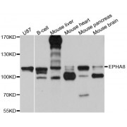 Western blot analysis of extracts of various cell lines, using EPHA8 antibody (abx125819) at 1/1000 dilution.