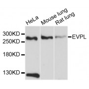 Western blot analysis of extracts of various cell lines, using EVPL antibody (abx125827) at 1/1000 dilution.