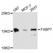 Western blot analysis of extracts of various cell lines, using FABP7 antibody (abx125834) at 1:3000 dilution.