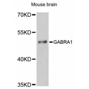 Western blot analysis of extracts of mouse brain, using GABRA1 antibody (abx125865) at 1:3000 dilution.