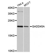 Western blot analysis of extracts of various cell lines, using GADD45A antibody (abx125868) at 1/1000 dilution.