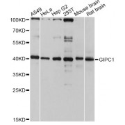 Western blot analysis of extracts of various cell lines, using GIPC1 antibody (abx125878) at 1:3000 dilution.