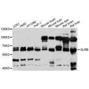 Western blot analysis of extracts of various cell lines, using GLRB antibody (abx125884) at 1/1000 dilution.