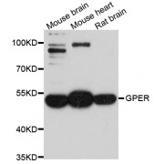 Western blot analysis of extracts of various cell lines, using GPER1 antibody (abx125895) at 1/1000 dilution.
