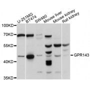 Western blot analysis of extracts of various cell lines, using GPR143 antibody (abx125900) at 1/1000 dilution.