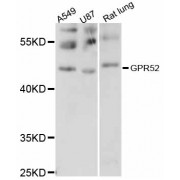 Western blot analysis of extracts of various cell lines, using GPR52 antibody (abx125902) at 1/1000 dilution.