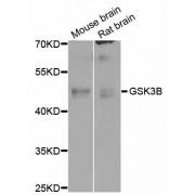 Western blot analysis of extracts of various cell lines, using GSK3B antibody (abx125917) at 1/1000 dilution.