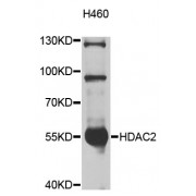 Western blot analysis of extracts of H460 cells, using HDAC2 antibody (abx125932) at 1/1000 dilution.