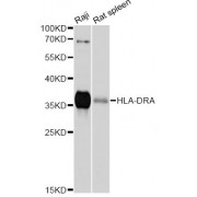 Western blot analysis of extracts of various cell lines, using HLA-DRA antibody (abx125949) at 1/1000 dilution.