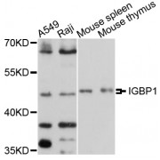 Western blot analysis of extracts of various cell lines, using IGBP1 antibody (abx125981) at 1/1000 dilution.