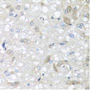 Immunohistochemistry of paraffin-embedded rat brain using IL6 antibody (abx125999) at dilution of 1/100 (40x lens).