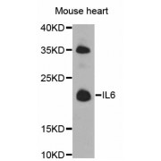 Western blot analysis of extracts of mouse heart, using IL6 antibody (abx126000) at 1/1000 dilution.
