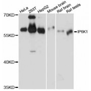 Western blot analysis of extracts of various cell lines, using IP6K1 antibody (abx126011) at 1/1000 dilution.