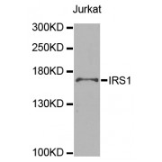 Western blot analysis of extracts of Jurkat cells, using IRS1 antibody (abx126017) at 1/1000 dilution.